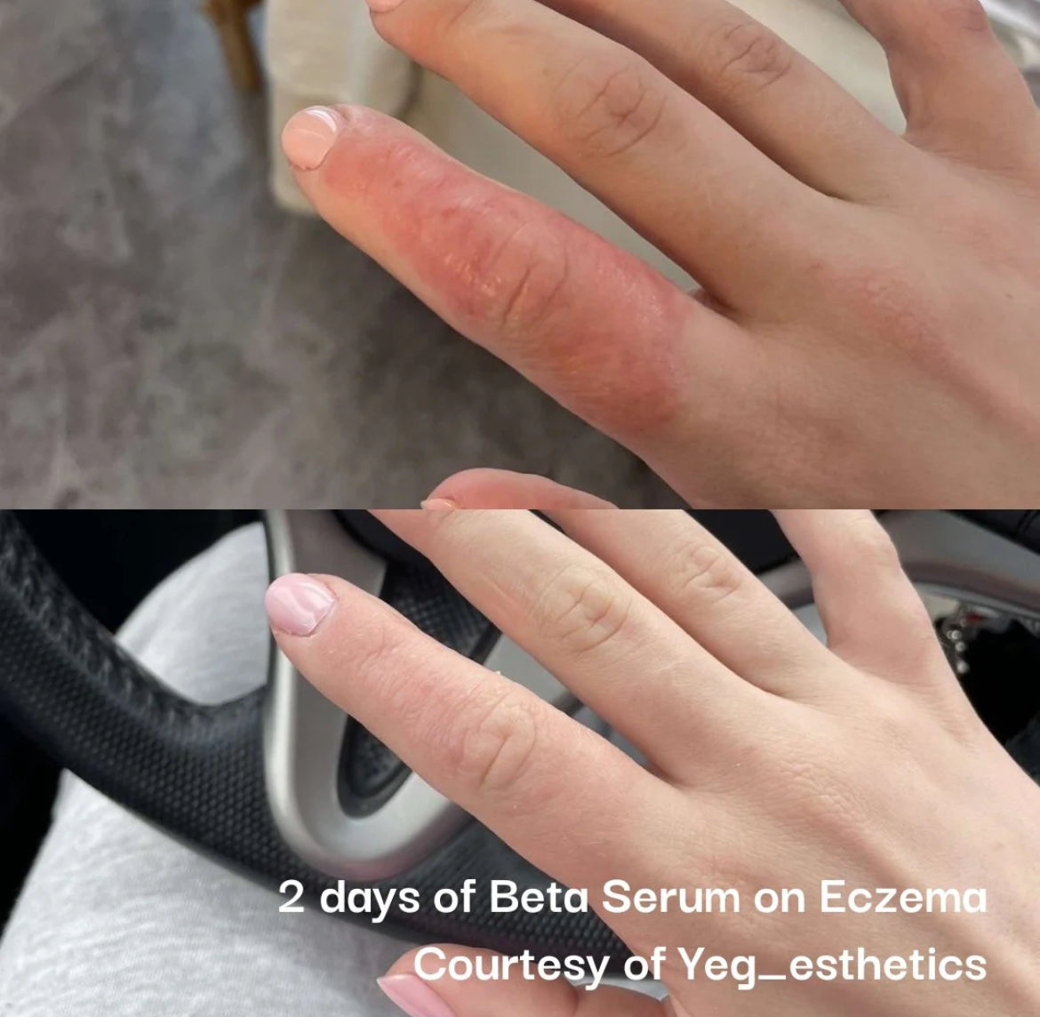 Neogenesis Beta-Glucan Serum
