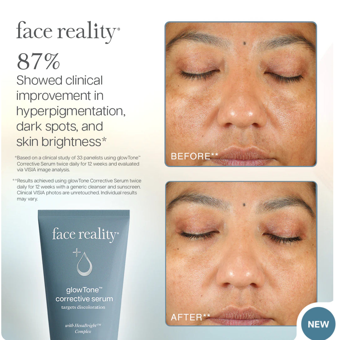 GLOWTONE™ CORRECTIVE SERUM